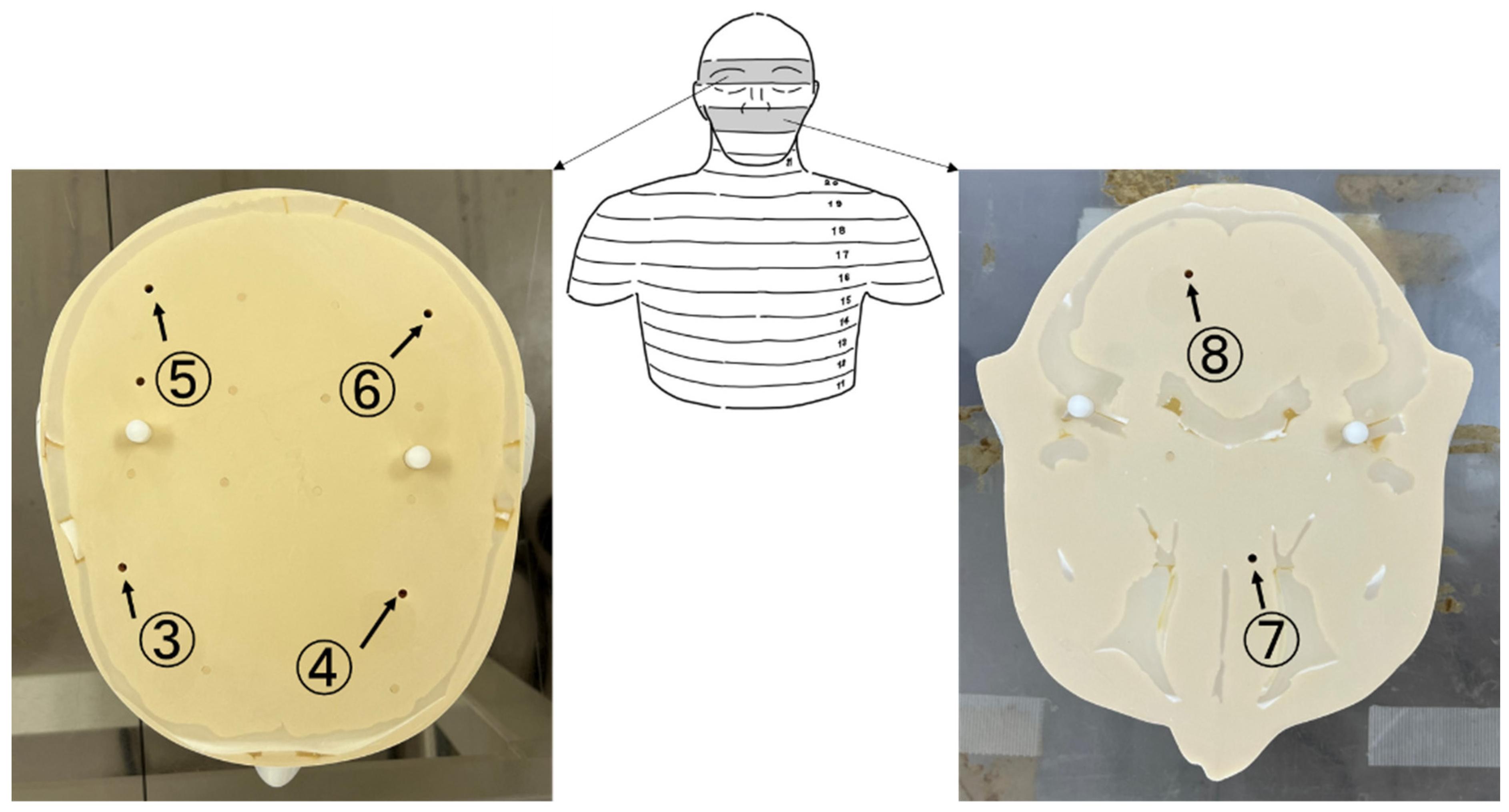 Radiation Exposure to the Brains of Interventional Radiology Staff ...